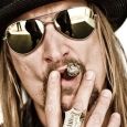  Kid Rock