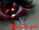 blood in the eyes